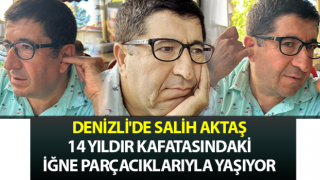 14 yıldır kafatasındaki iğne parçacıklarıyla yaşıyor