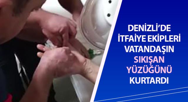 Yüzüğe sıkışan parmağı itfaiye ekipleri kurtardı