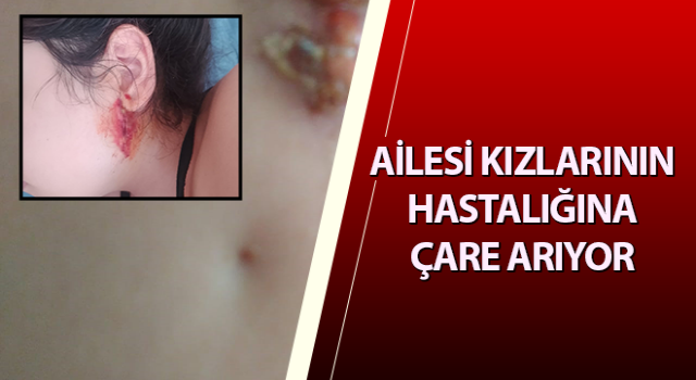 Ailesi kızlarının hastalığına çare arıyor