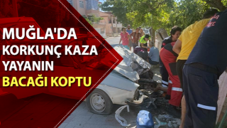 Direk ile araç arasında kaldı, bacağı koptu