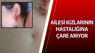 Ailesi kızlarının hastalığına çare arıyor